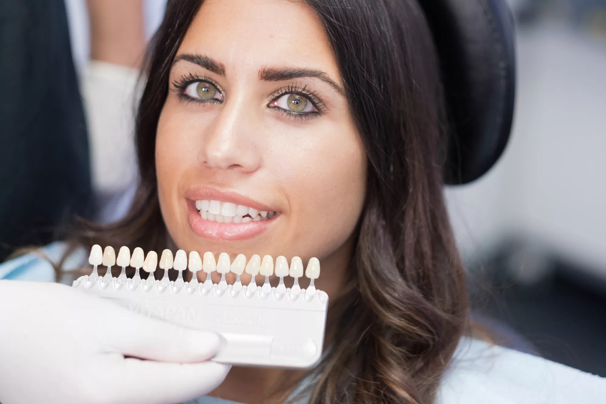 Hollywood Smile Cost in Istanbul 2025